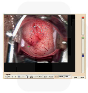 Software p/ Colposcópio COLPRO/COLDY c/ câmara digital                         