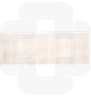 Papel rolo ECG 210mmx30m cx5 