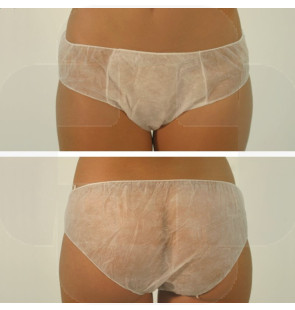 Cueca em não tecido de 30 g/m². tamanho médio cx 100
