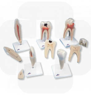 Modelo anatómico Série clássica de modelos de dente, 8 vezes o tamanho natural 5 modelos