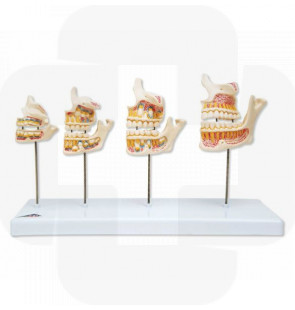 Modelo anatómico Desenvolvimento da Dentição