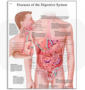 Póster As Doenças do Sistema Digestivo