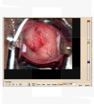 Software p/ Colposcópio COLPRO/COLDY c/ câmara digital                         