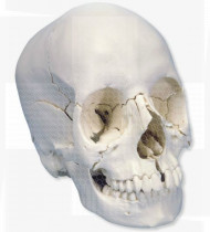 Modelo anatómico Crânio de encaixe Versão anatómica em 22 partes