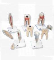 Modelo anatómico Série clássica de modelos de dente, 8 vezes o tamanho natural 5 modelos